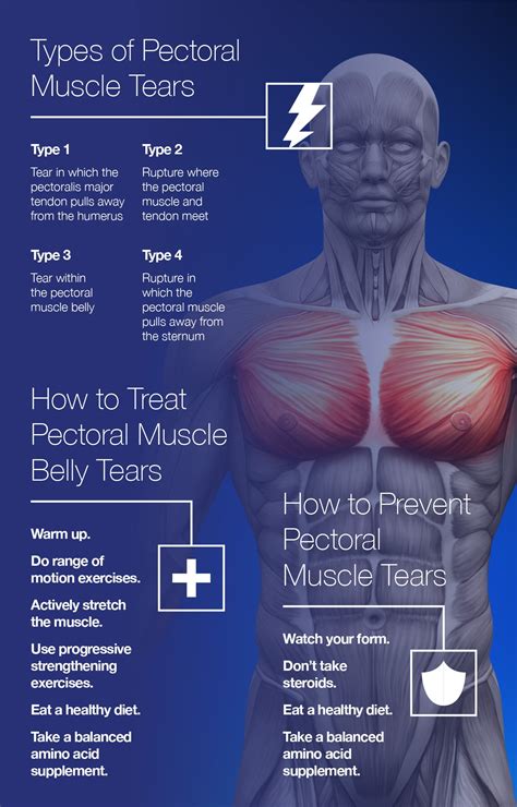 tear in pectoralis muscle